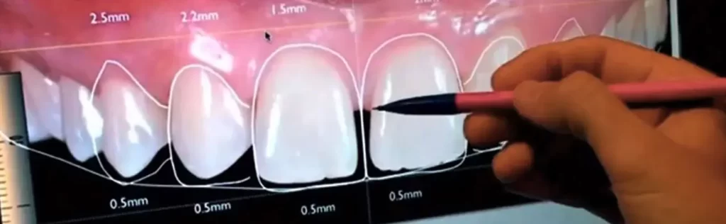 Odontoiatria digitale