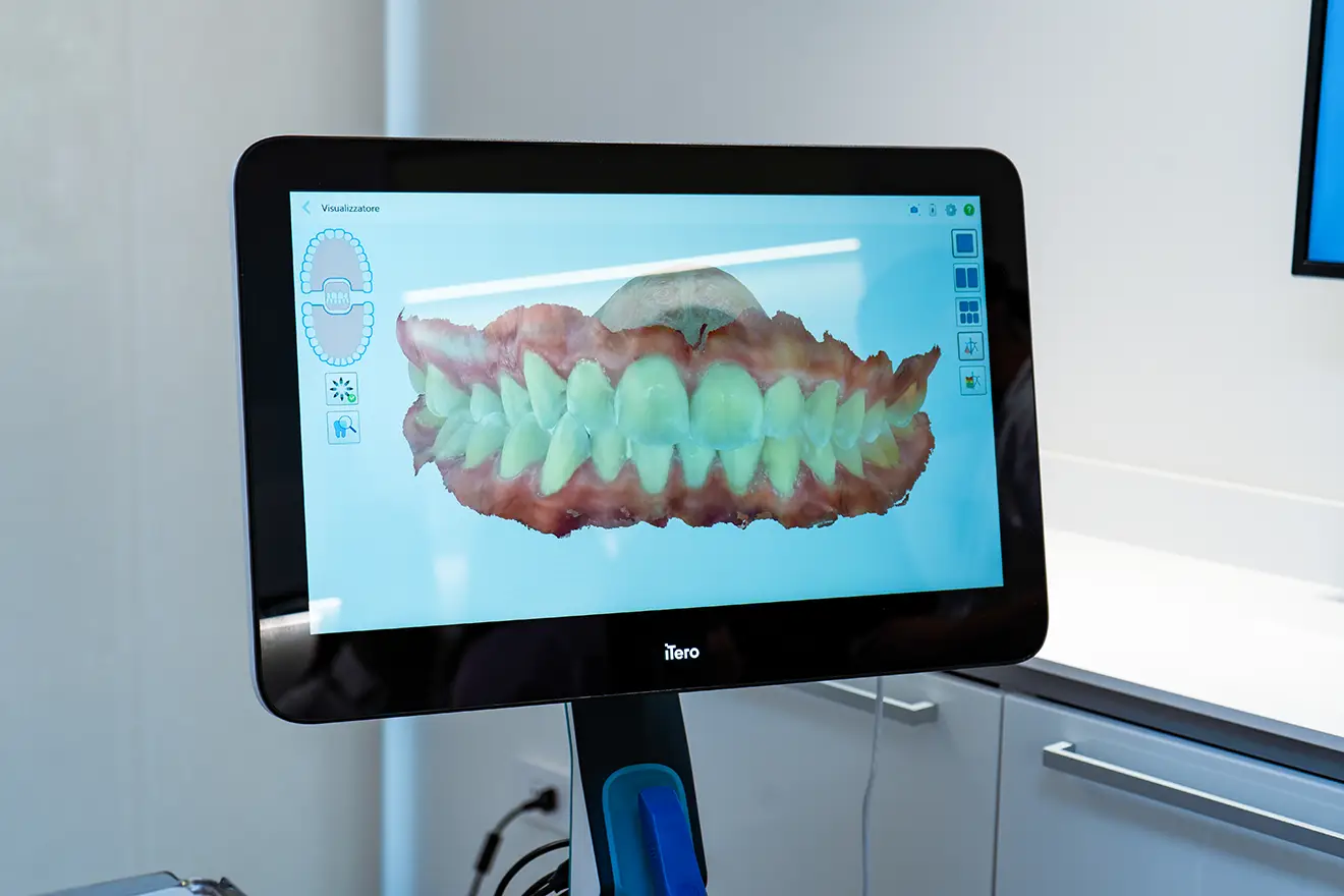 Scanner intraorale